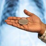 Busting Myths About Pacemakers - Dr Sanjay Kumar