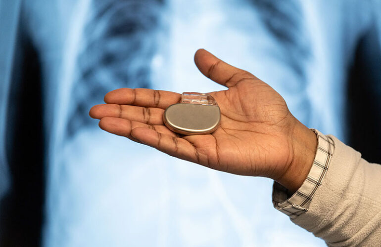 Busting Myths About Pacemakers - Dr Sanjay Kumar