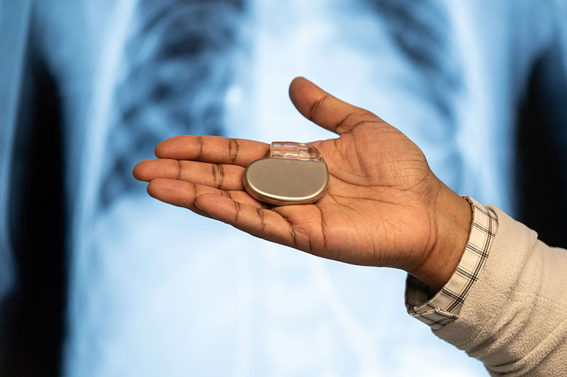 Busting Myths About Pacemakers - Dr Sanjay Kumar