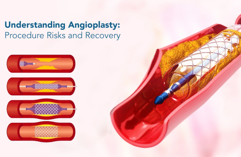 Understanding-Angioplasty-Procedure-Risks-and-Recovery