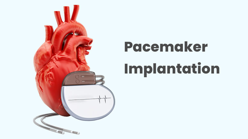 Pacemaker-Implantation